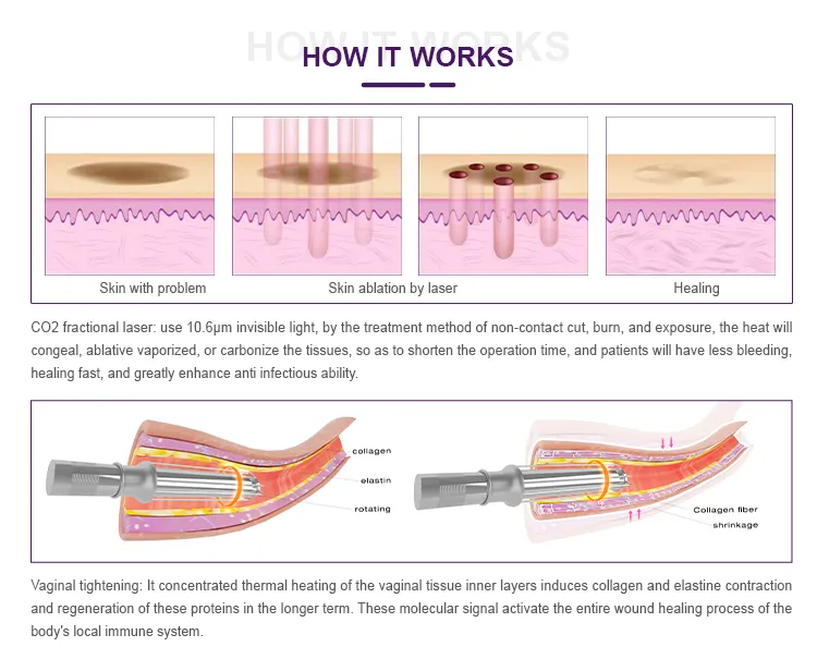 How It Works Diagram
