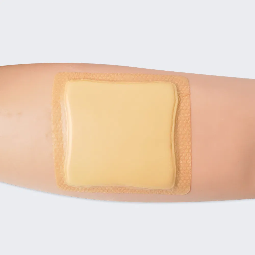 Silicone Foam Dressing 5