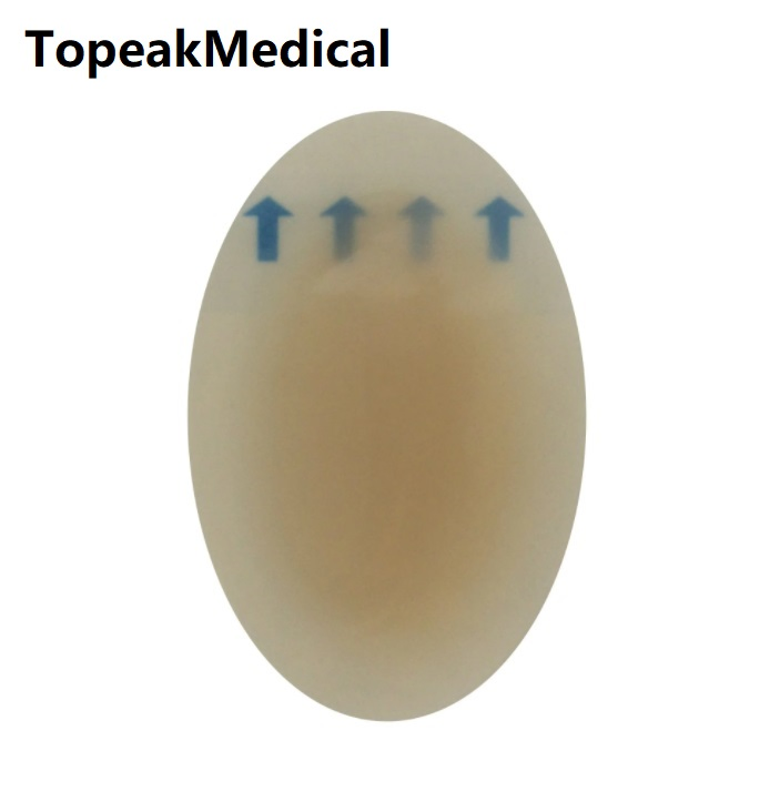 Wound Care Adhesive Hydrocolloid Dressing