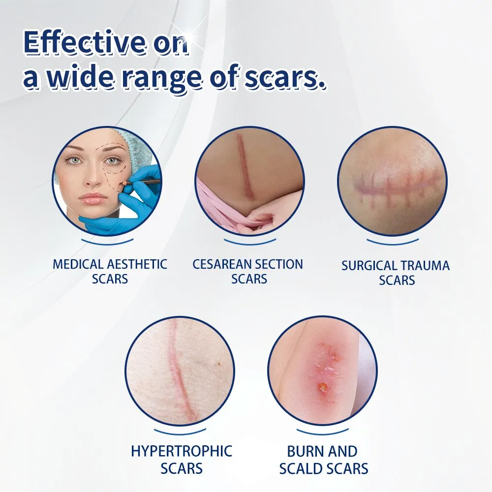 Advanced Silicone Scar Tape Roll for Keloid &amp; Burn Scars Treatment Medical Grade Silicone Gel Sheet for Scar Healing