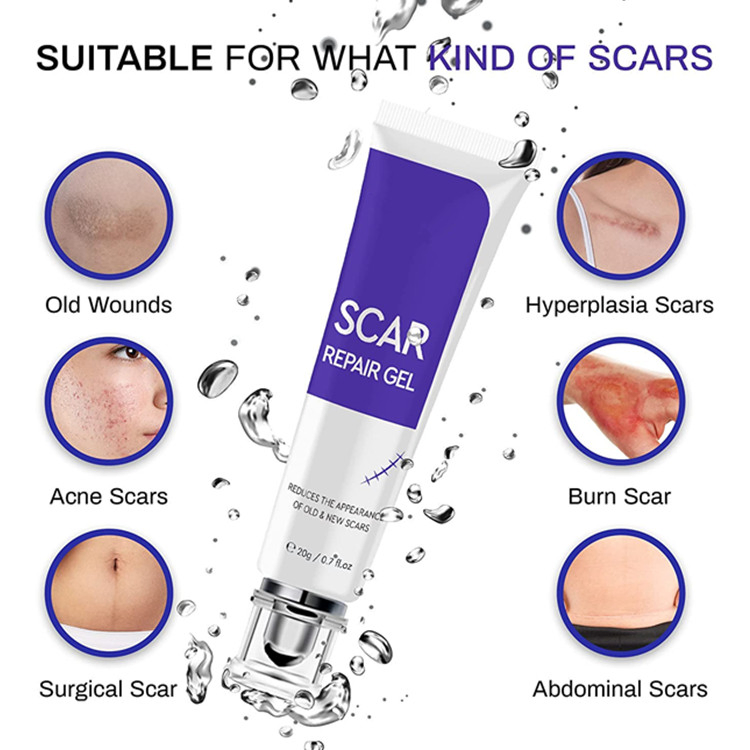 OEM ODM Advanced Scar Treatment Removal Cream Scar Repair Gel