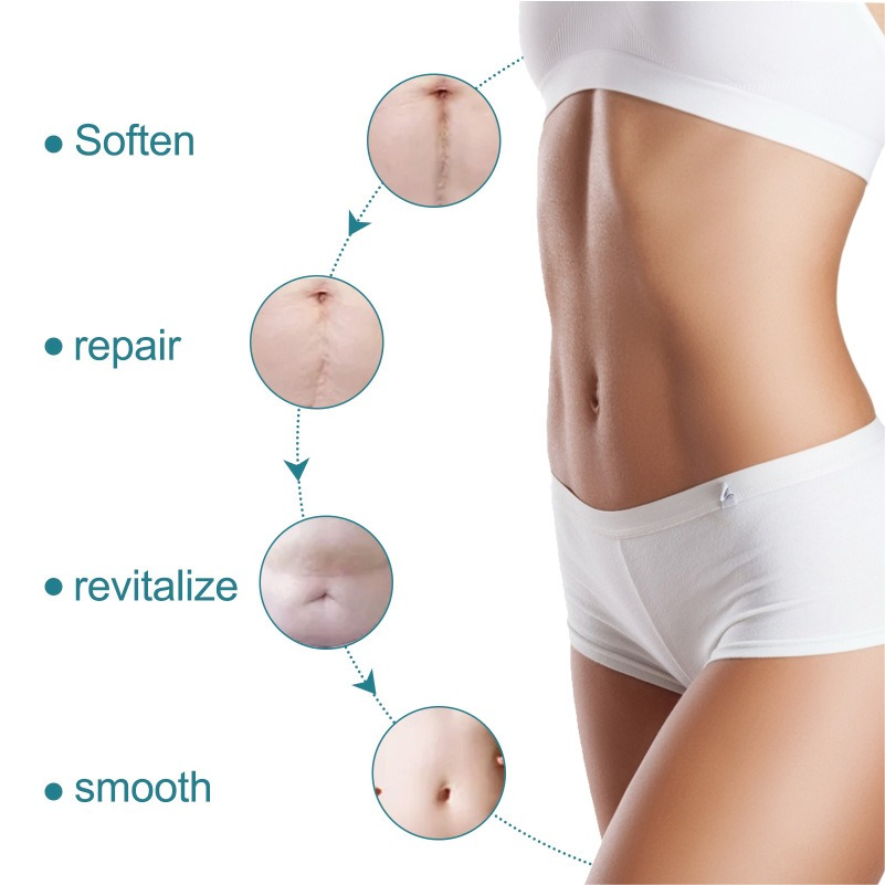 Scar Healing and Skin Repair Silicone Scar Tape Silicone Scar Sheets