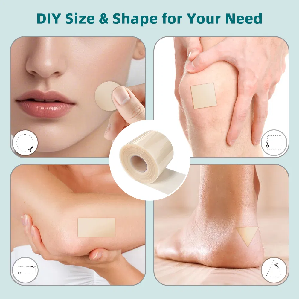 Hydrocolloid Wound Dressing Roll for Fast Healing Relief