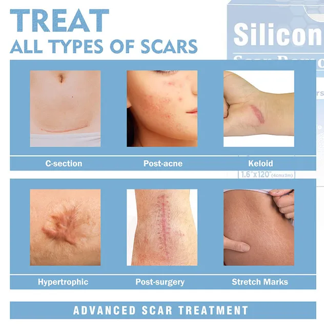 Packaging Box Detail 2