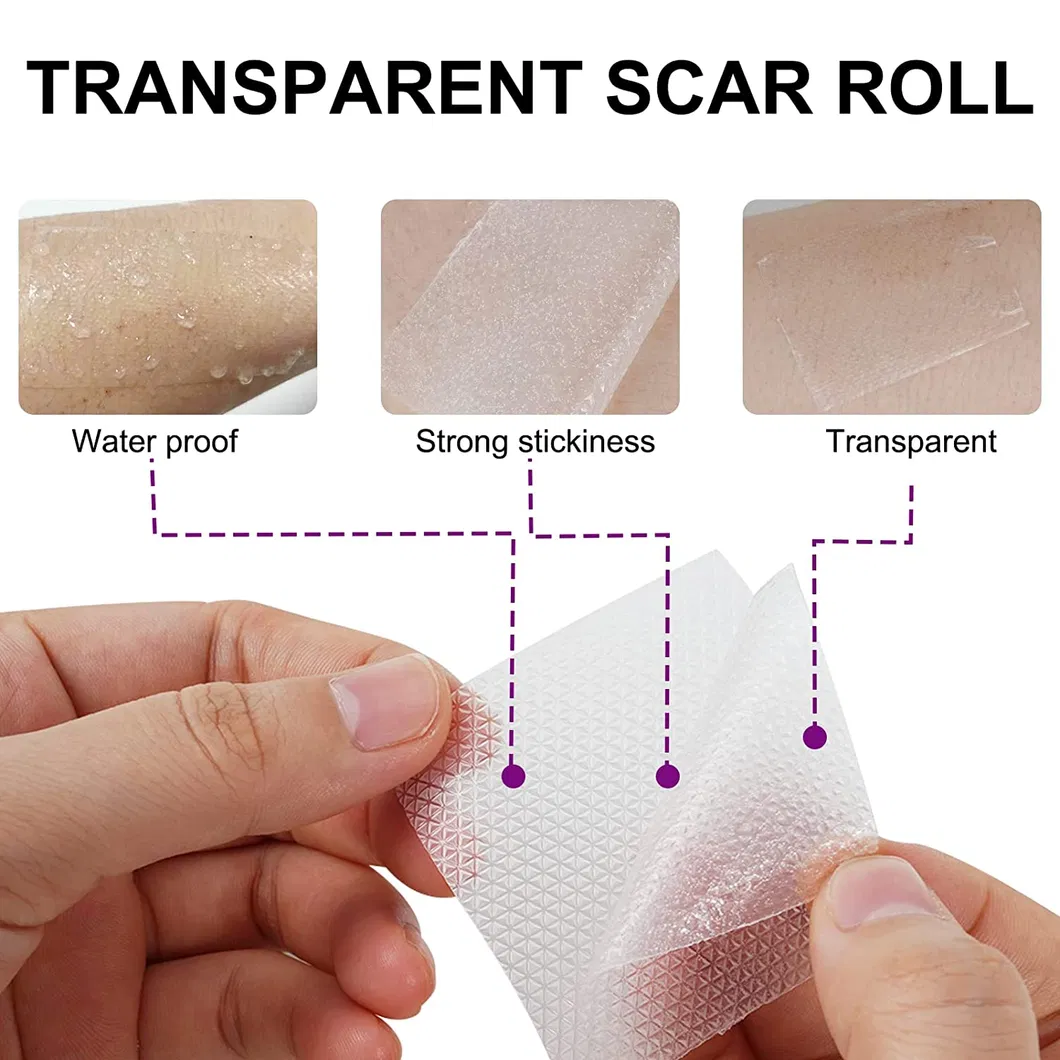 Scar Treatment Details