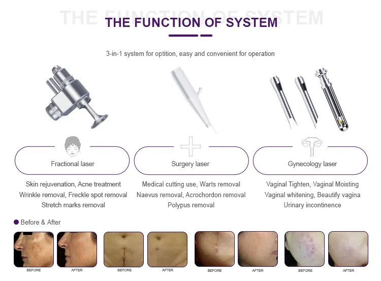 Skin Treatment Machine