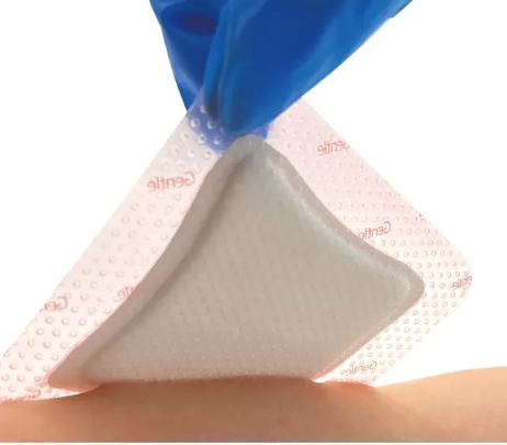 Antibacterial/ Antimicrobial Silver Foam Dressing for Wound Care