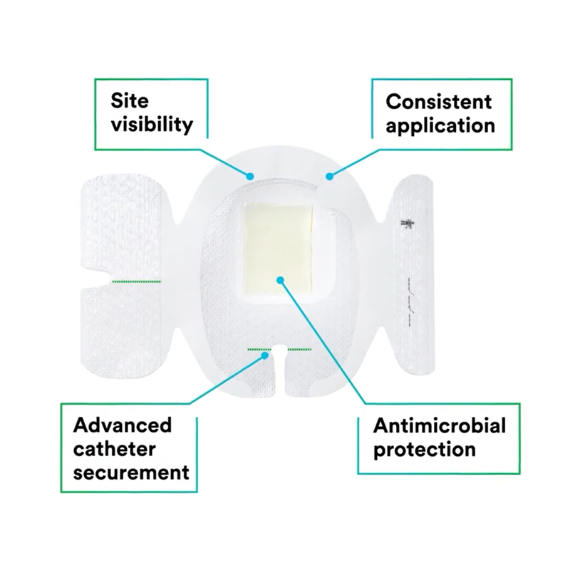 Transparent 2% Chlorhexidine Gluconate Chg IV Catheter/Cannula Fixation Dressing