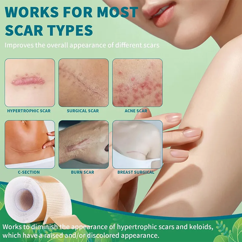 Silicone Scar Sheets Display 2