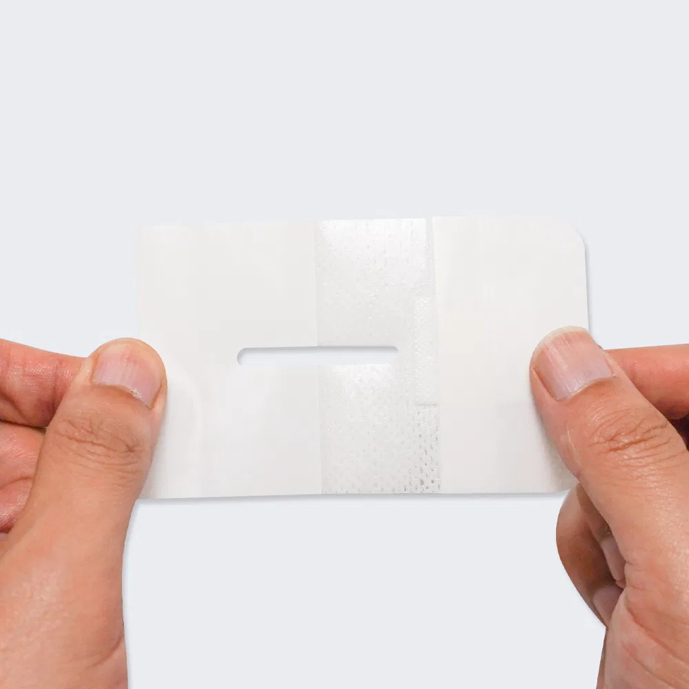 Disposable Waterproof Self-Adhesive I. V. Cannula Fixing Dressing Non Woven Island Wound Plaster with Pad