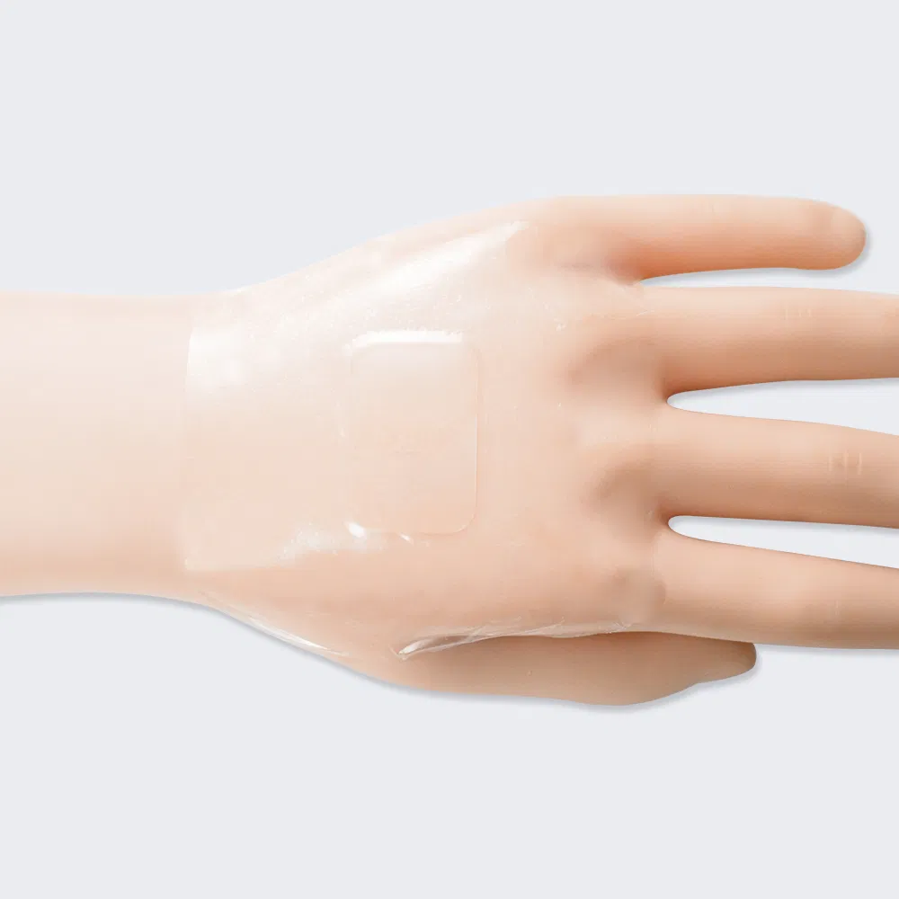 Wound Care Dressing 1