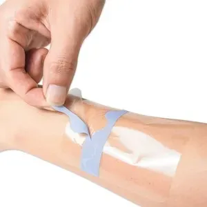 IV catheter dressing 2