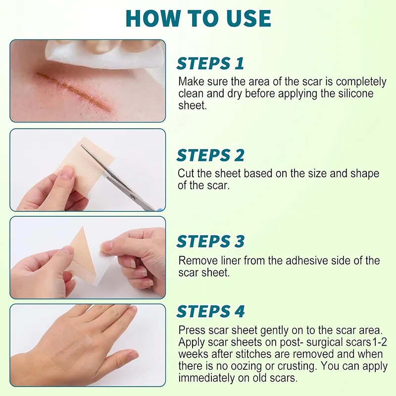 Silicone Scar Sheets Display 4