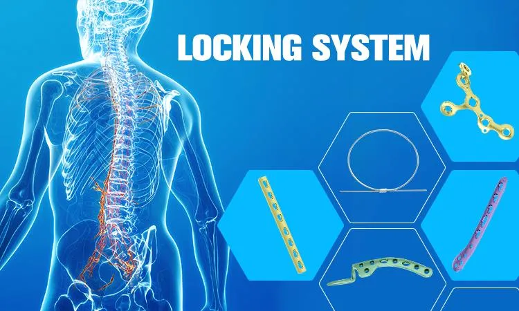 Trauma Locking Plate 1