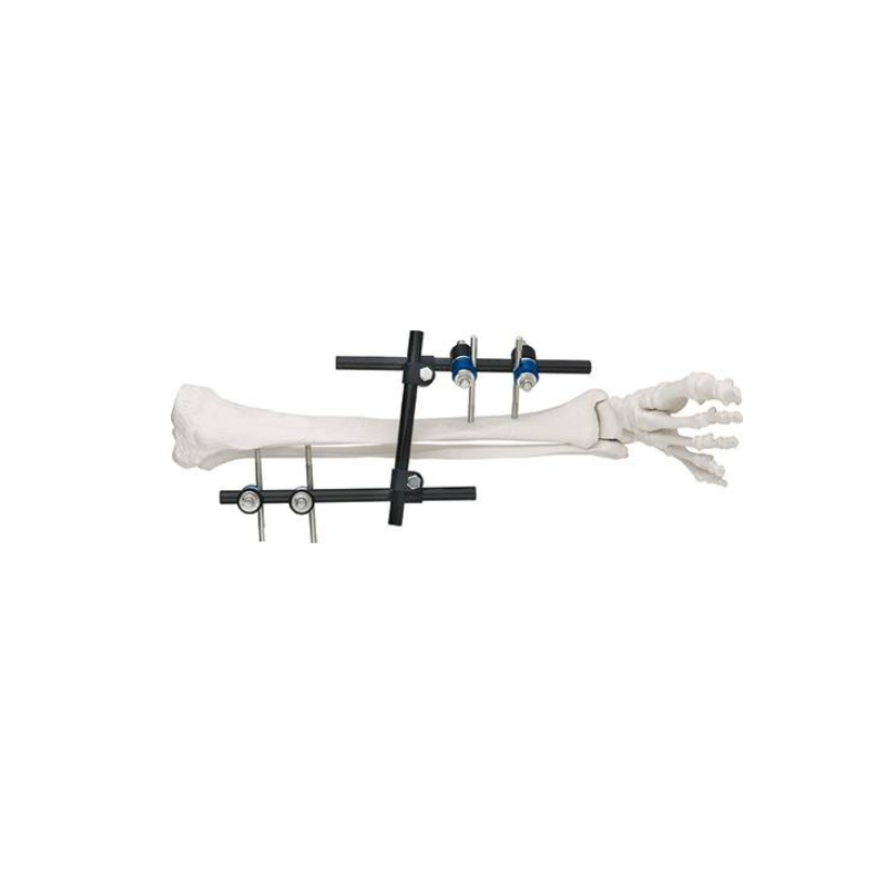Straight Type Combination Lower Limb External Fixator