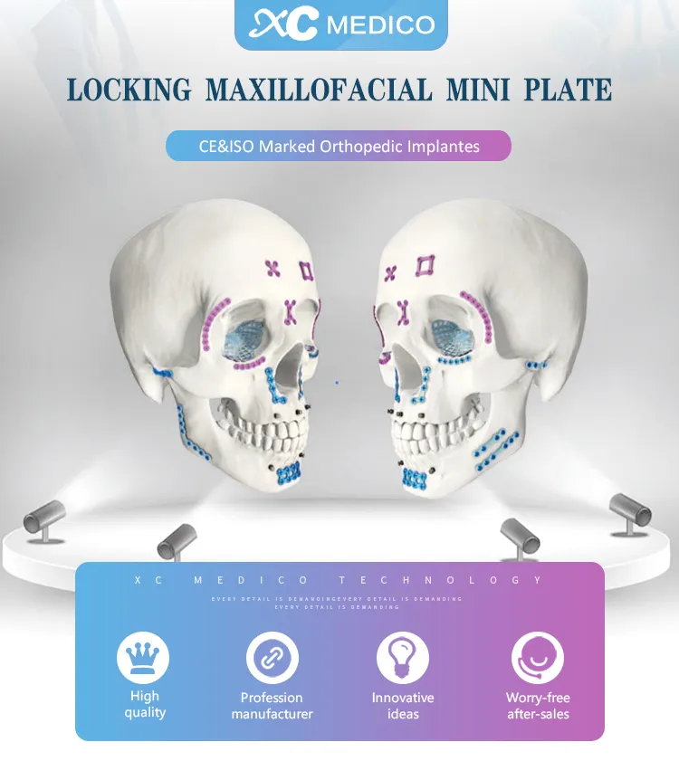 Cmf Implants 4