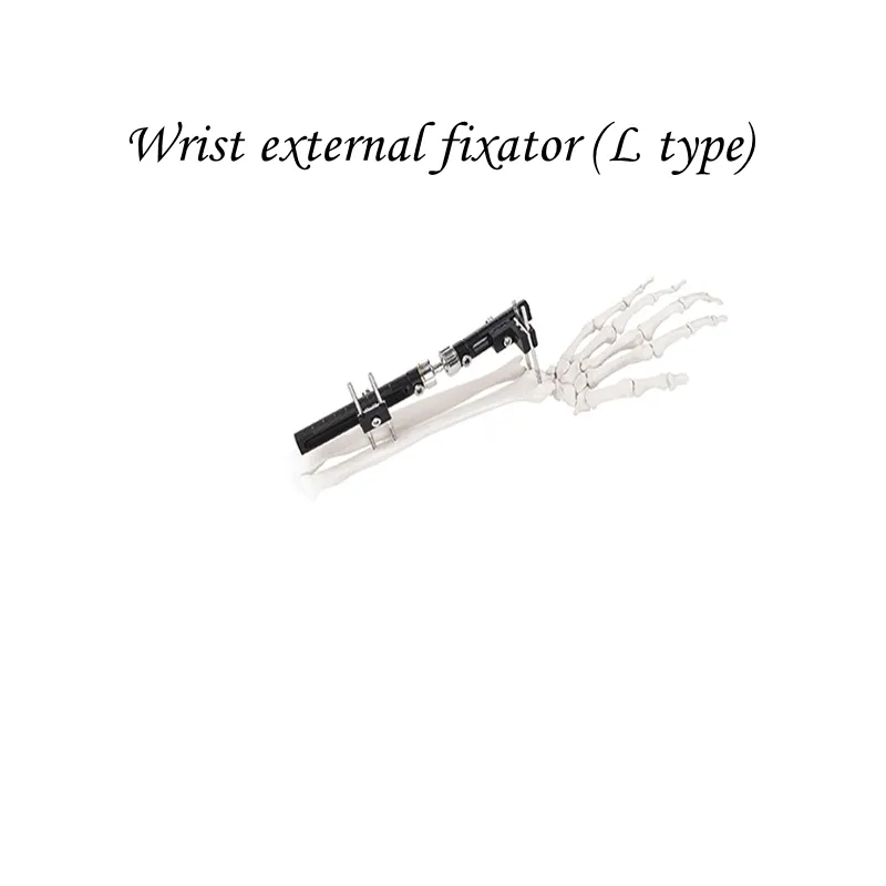 Wrist External Fixator