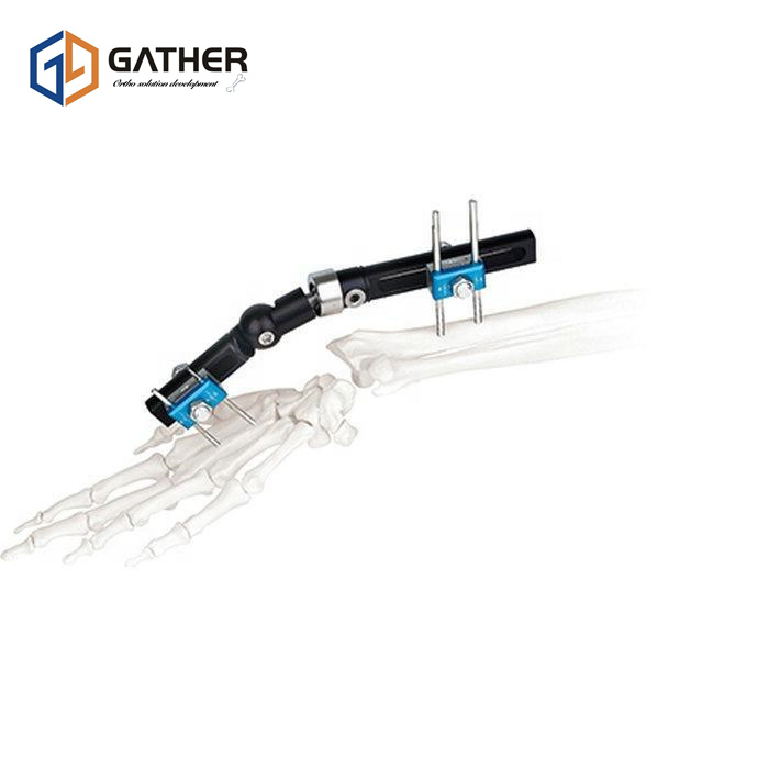 Cheap Price Fracture Fixation Wholesale Piece Splint Posture Corrector External Fixator with ISO