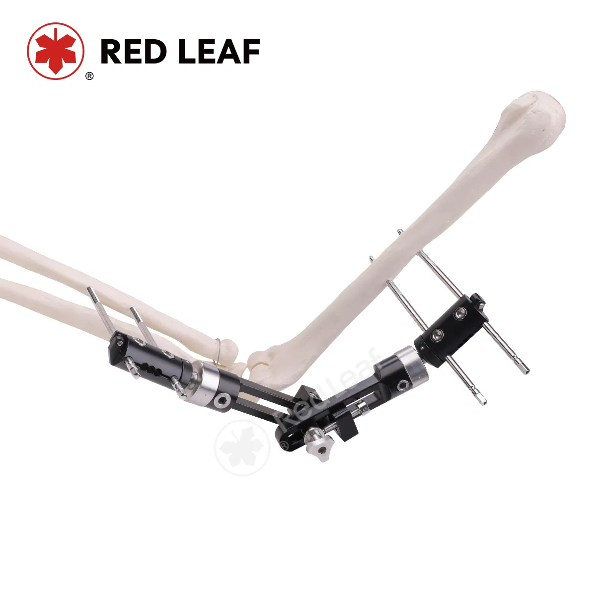 Orthopedic Elbow External Fixation Joint Fixator for Trauma Fracture Solution