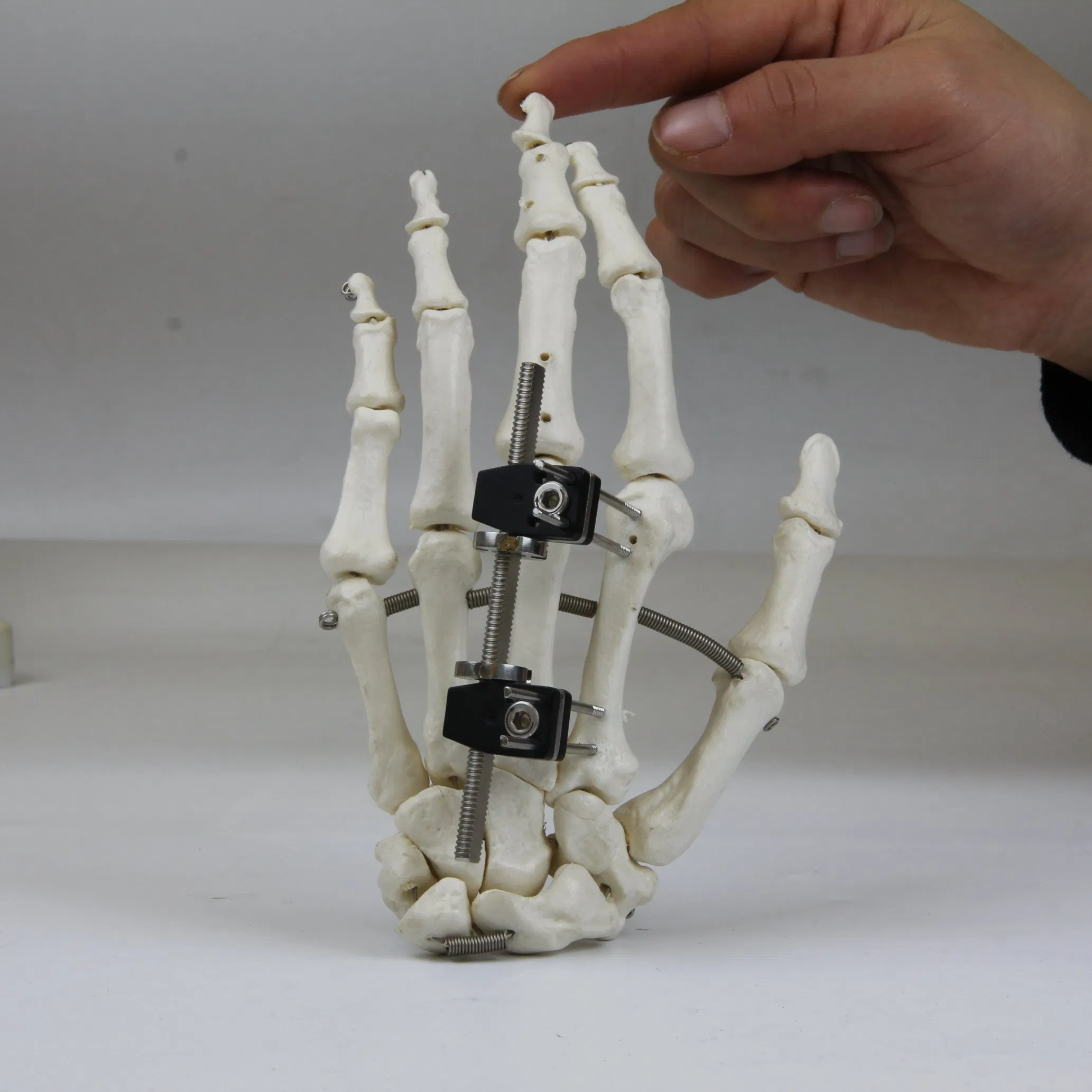 Universal Mini Palm External Fixator for Finger Fracture Orthopedic Surgical