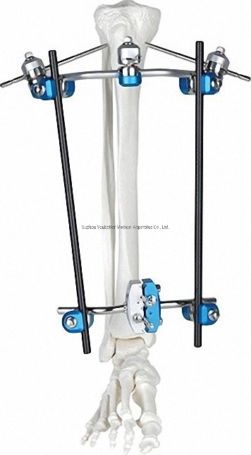 Titanium Bone Fixator Kit in Sleek White and Black