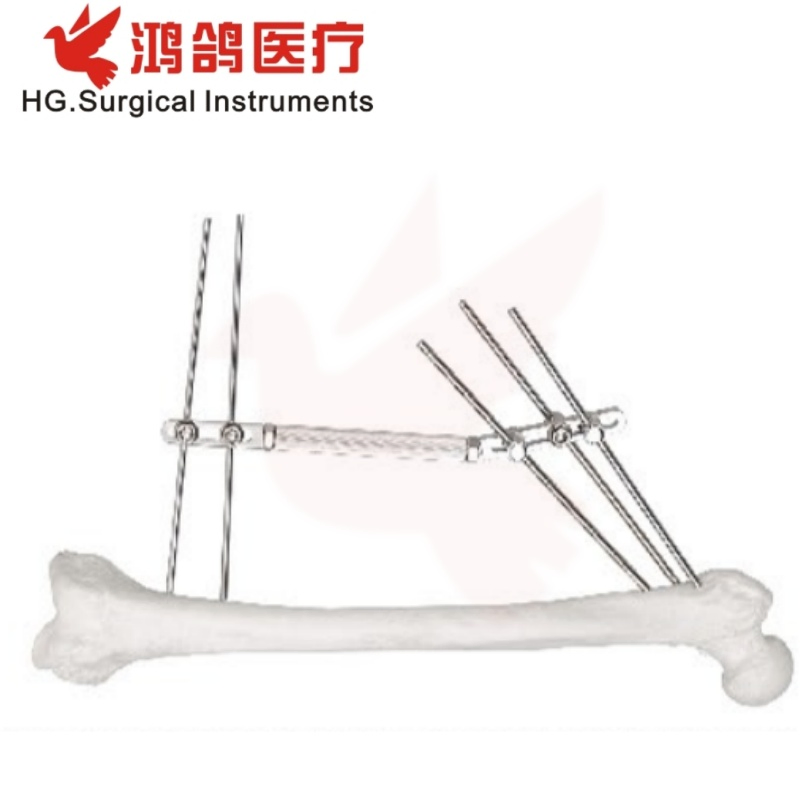 Orthopedic Instrument Dynamic External Fixator Orthopedic Implant Hospital Instrument Medical Device
