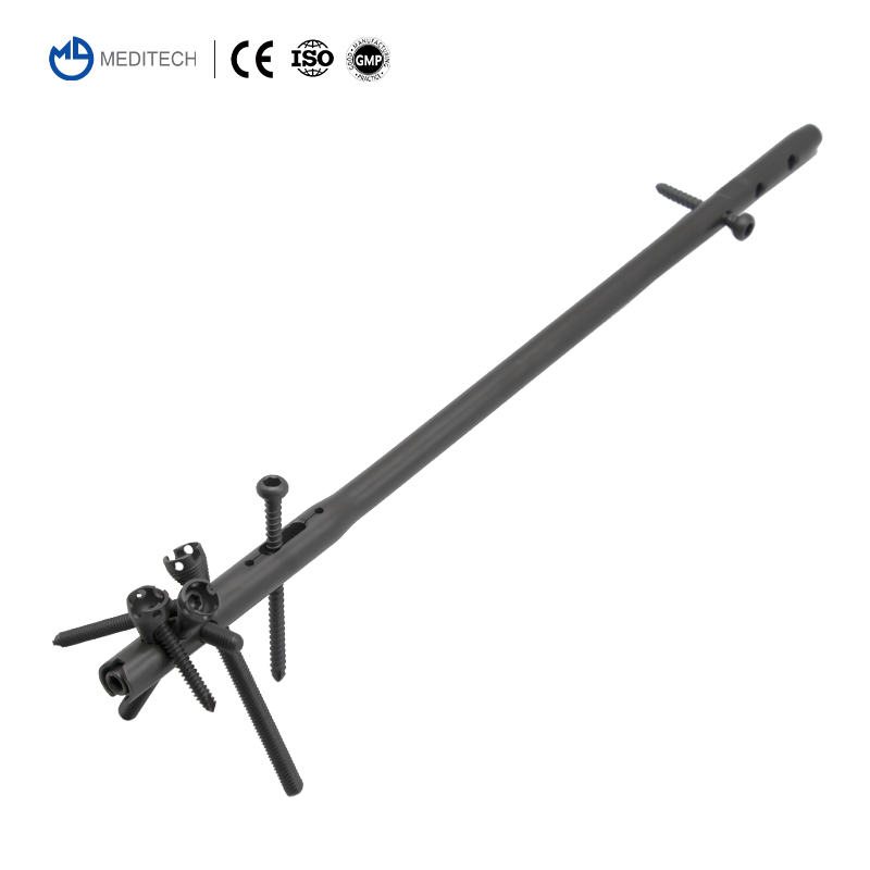 Titanium Orthopedic Surgical Implant Suprapatellar Approach Tibial Intramedullary Nail