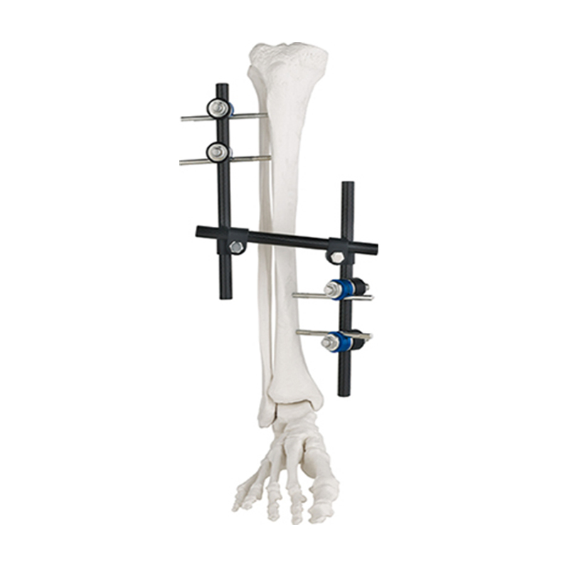Ao Design Combination T Frameexternal Fixator for Orthopedic Fixation