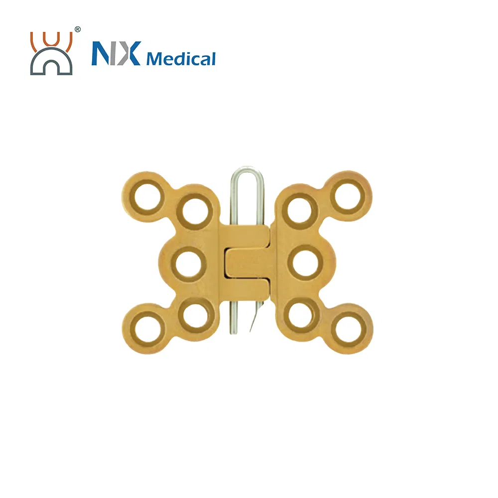 Nx Medical Locking Plates LCP Sternum 2.9mm System Implants for Orthopedic Fixation
