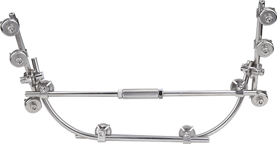 Parts &amp; Instruments of Cyclic Annular External Fixator External Fixation