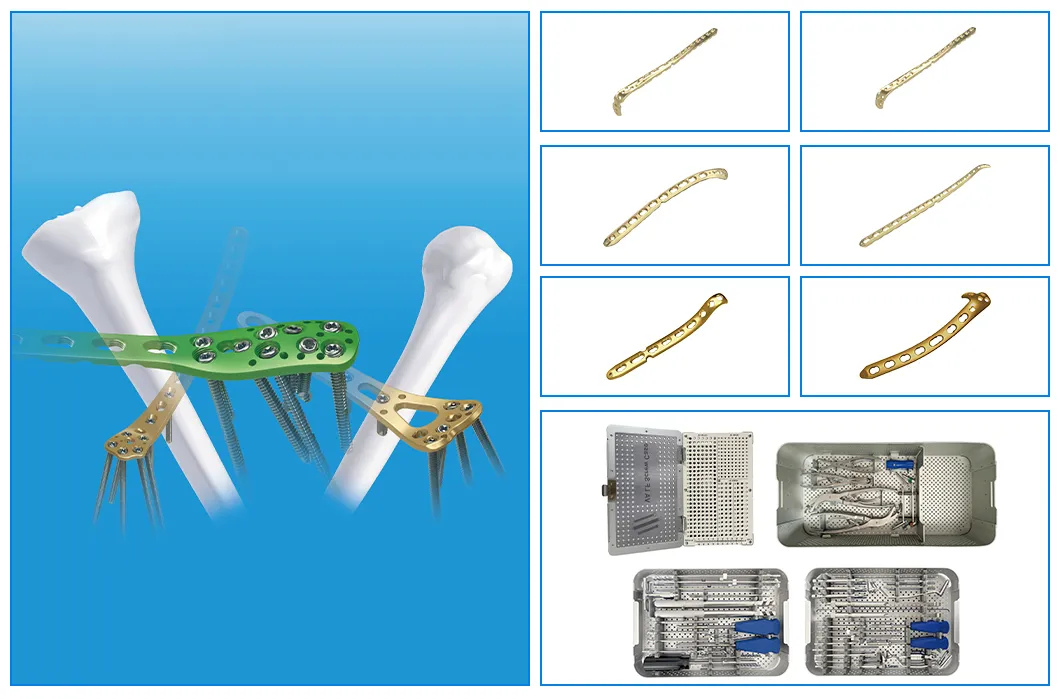 Key Features of LCP Plate