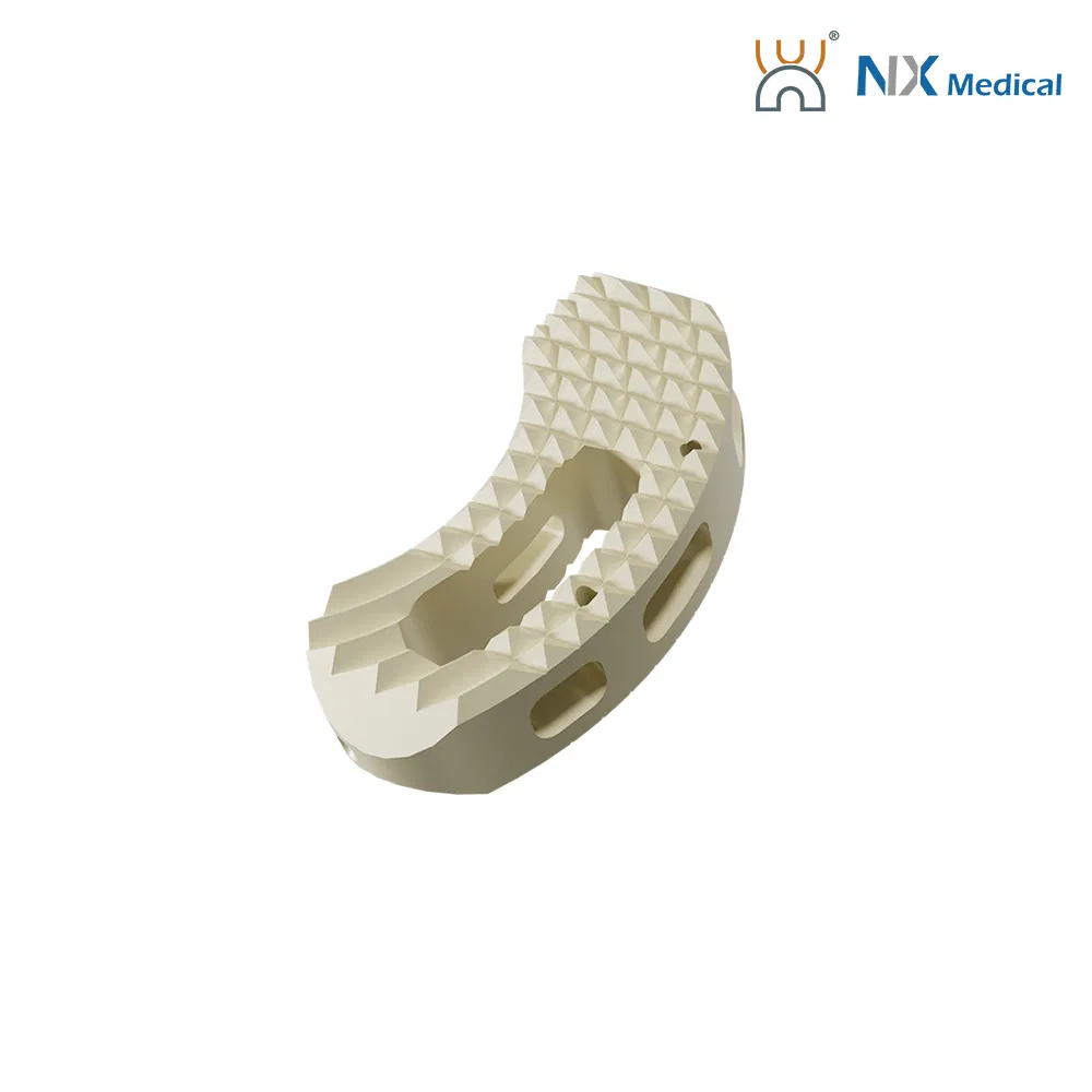 Nx Medical OEM Support Tlif Cage Peek Titanium for Lumbar Interbody Fusion