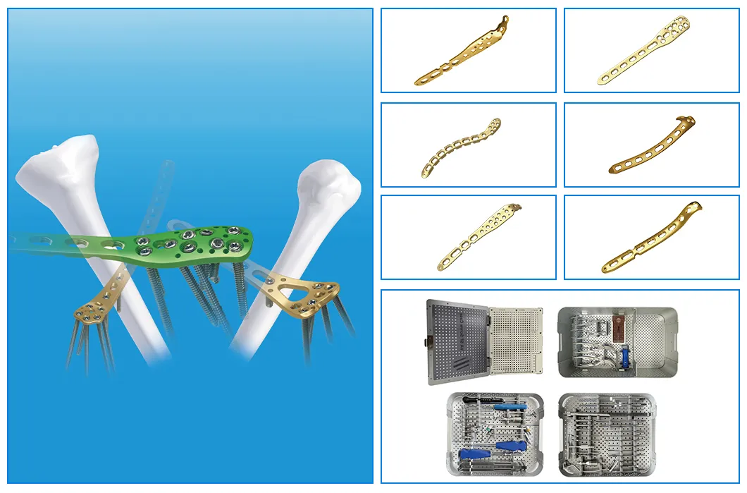 Variable Angle Locking Plate