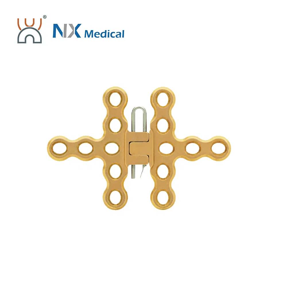Nx Medical Locking Plates LCP Sternum 2.9mm System Implants for Orthopedic Fixation