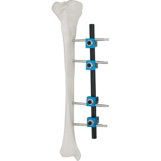 Cheap Price Fracture Fixation Wholesale Piece Splint Posture Corrector External Fixator with ISO
