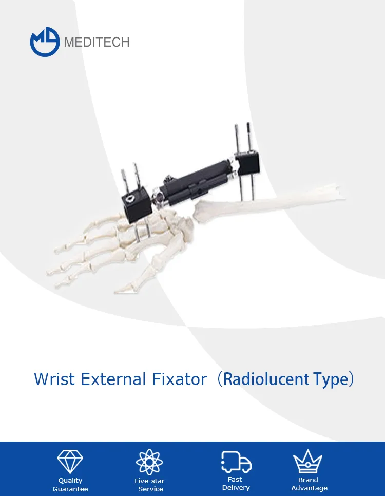Wrist Joints External Fixator 1