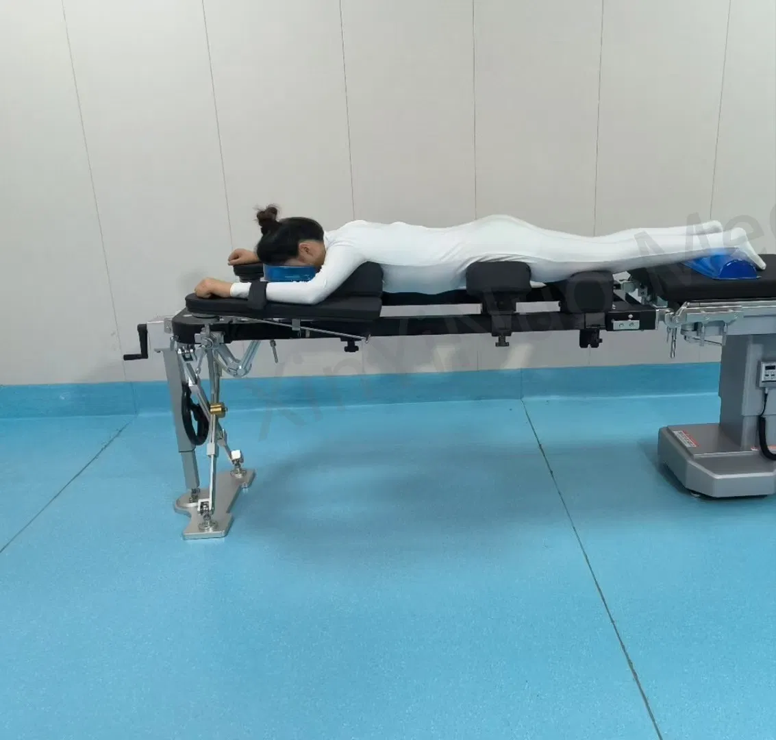 Carbon Fiber Spinal Frame System - Comprehensive Surgical Solution for Cervical/Cranial/Spinal Procedures