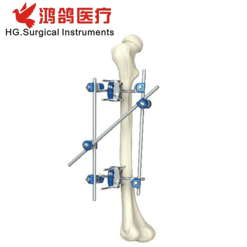 Orthopedic Instrument Combination External Fixator Orthopedic Product Medical Supply Hospital Equipment