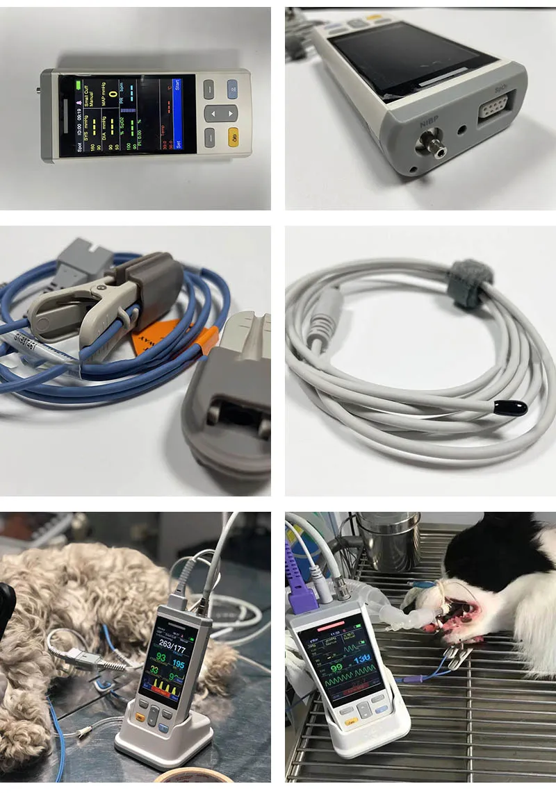 Patient Monitor Details