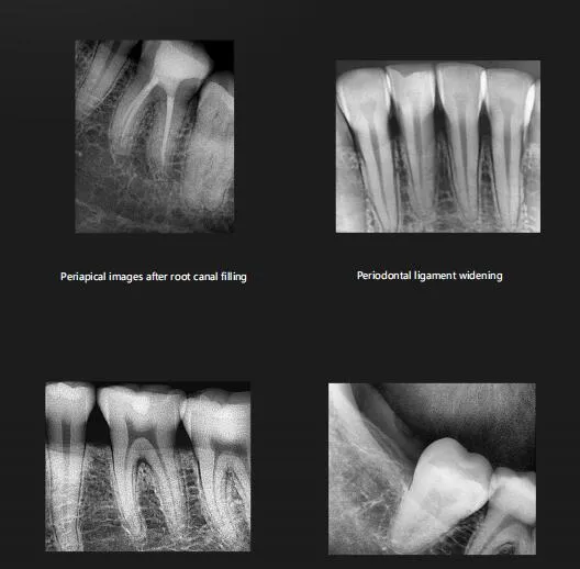 Intraoral Sensor Details