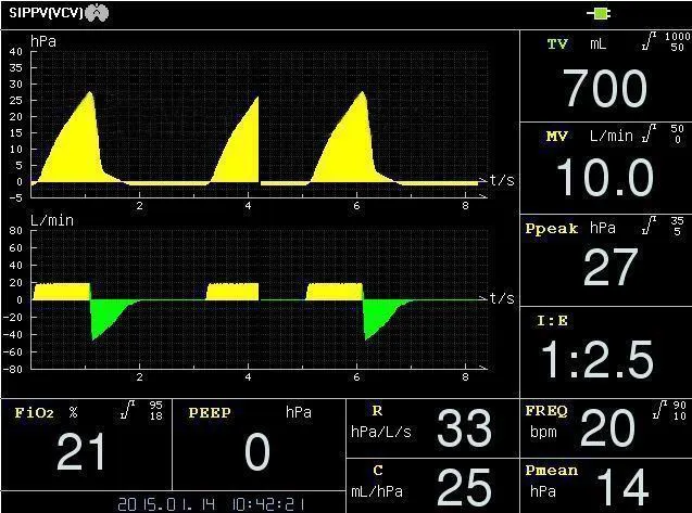 Ventilator Component 4