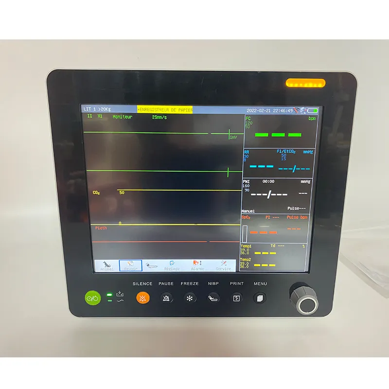 Vet Monitor Detail 4