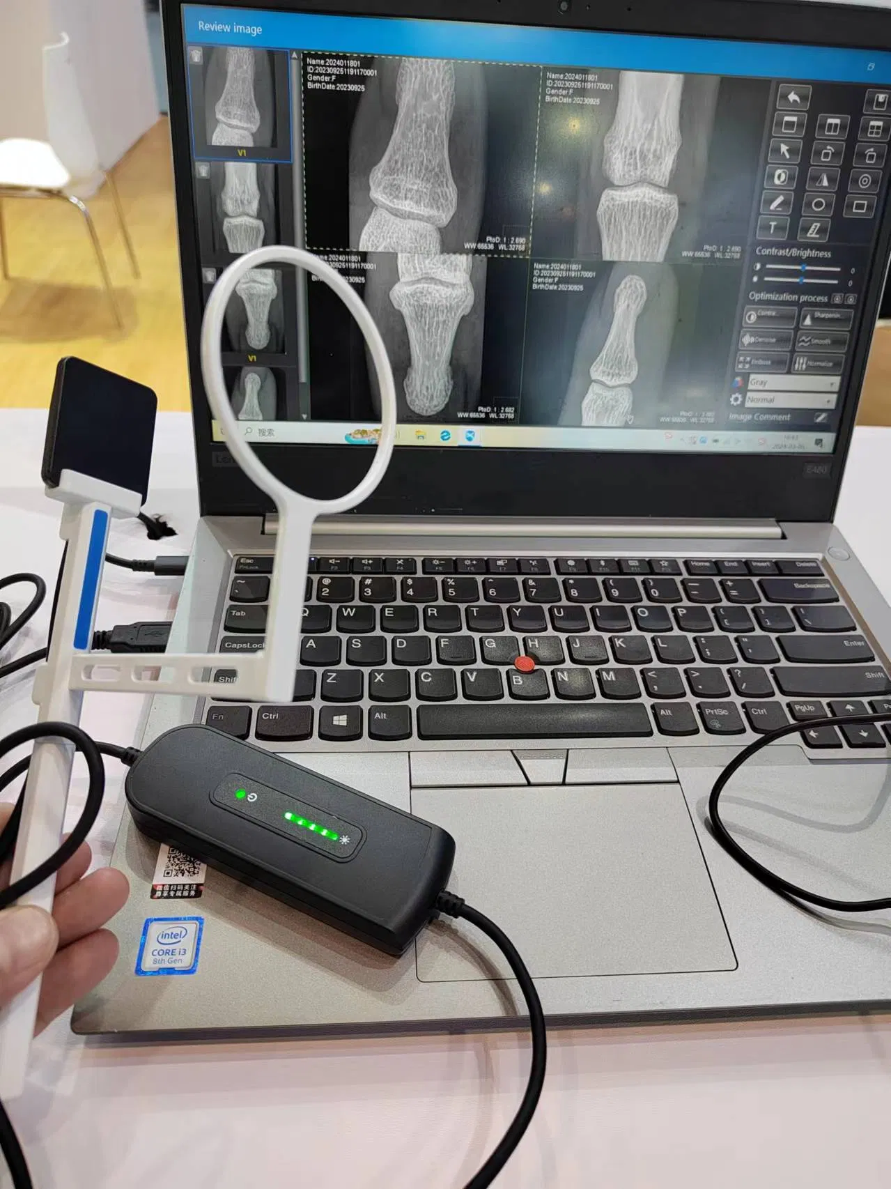 Veterinary Use Dental Portable X Ray Rvg Digital Sensor Dental Equipment