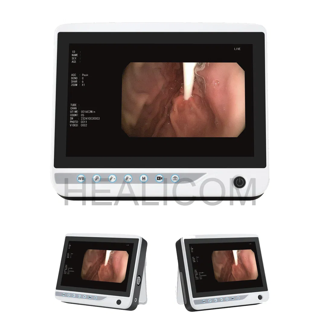 Pet Hospital 10-Inch Display Portable Veterinary Endoscopy System