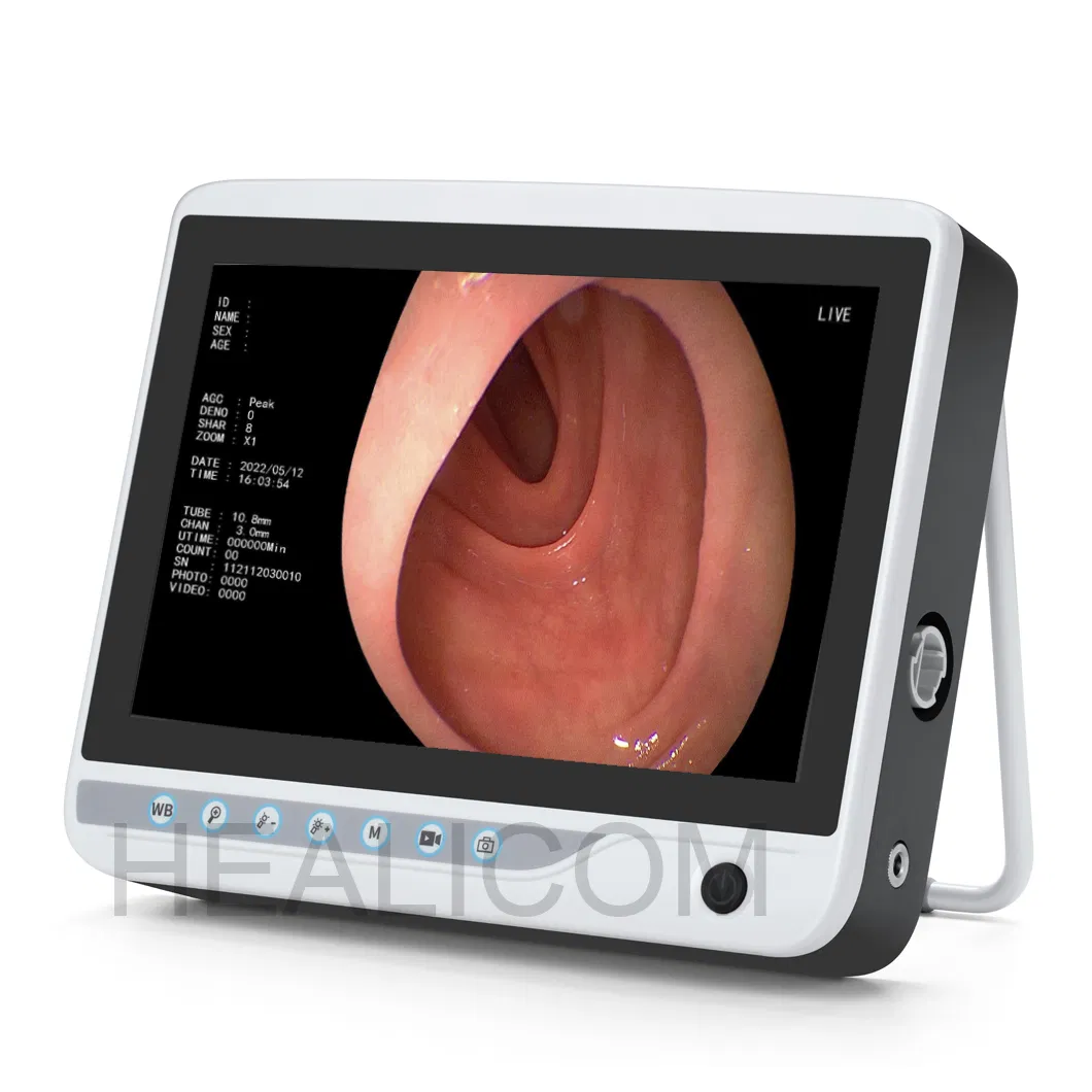 Pet Hospital 10-Inch Display Portable Veterinary Endoscopy System