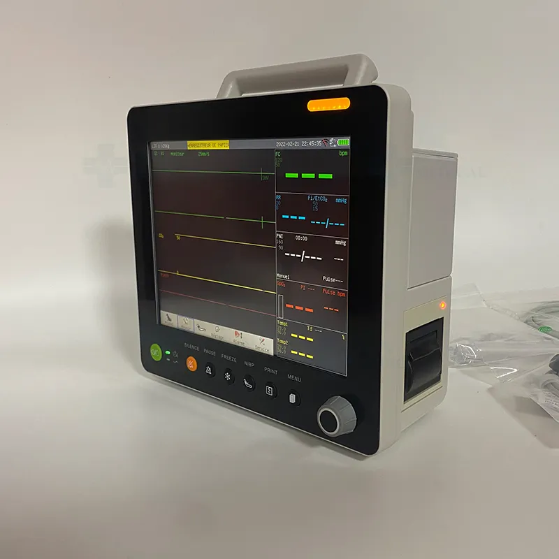 Vet Monitor Detail 3