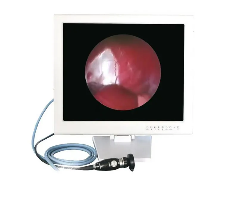 HD Endoscopy System