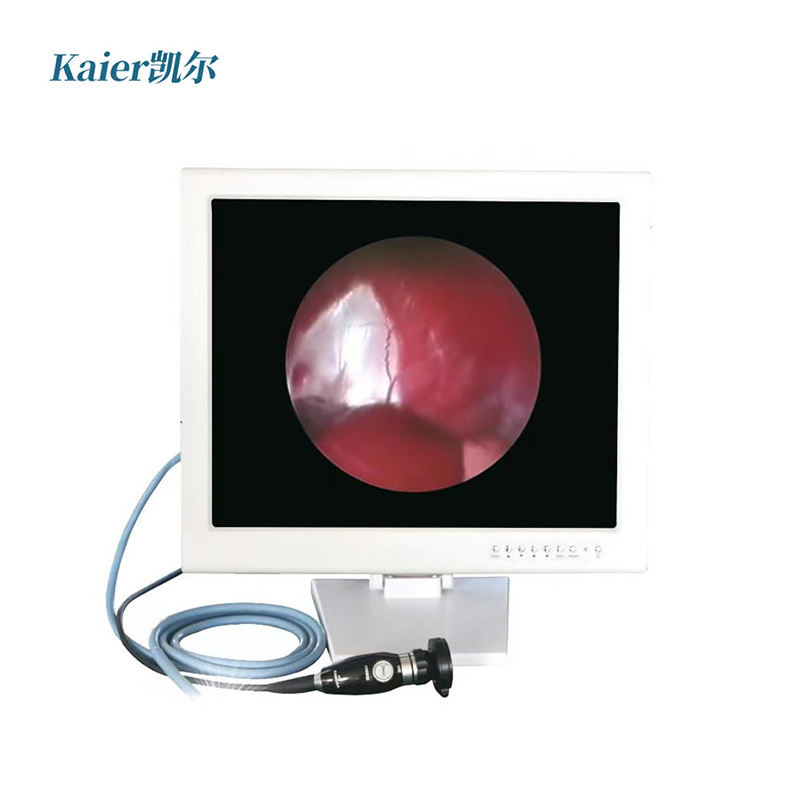 Hospital Instrument Video Endoscopy Camera Gastroscope Colonoscope Medical Endoscope Video Gastroscope System