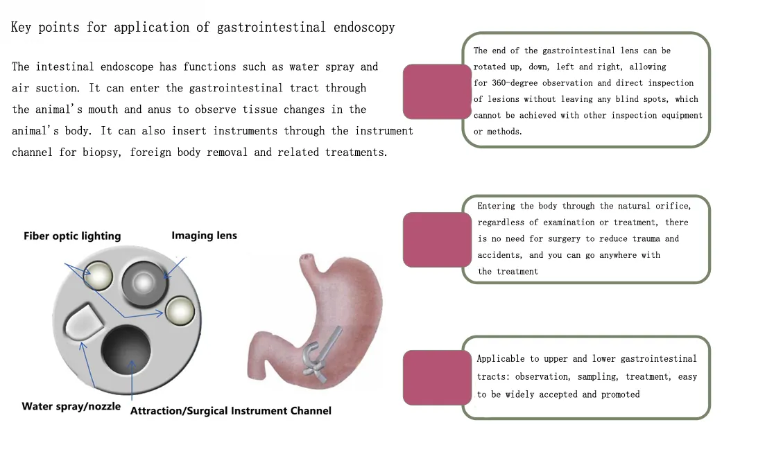 Medical Video Gastroscope