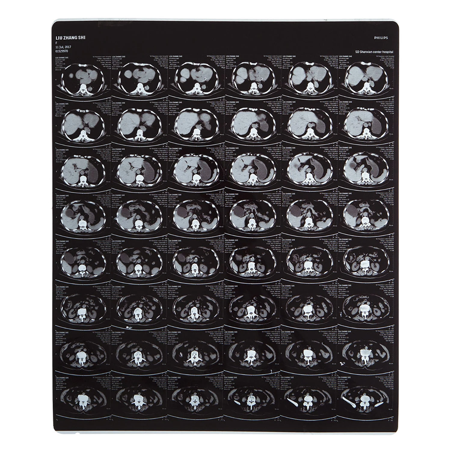 FUJI Printer Using Laser/Thermal Medical X-ray Film 35X43 Cm